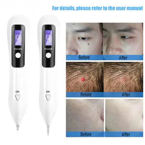 CAUTERIZADOR DE VERRUGAS: Elimina Verrugas, Manchas y Tatuajes con Precisión - CAUTERIZADOR DE VERRUGAS