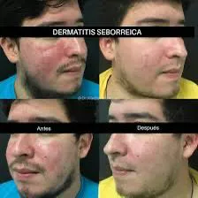 Descubre Kolmax™