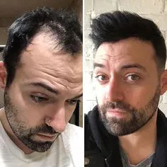 Shampoo Capilar Mechudos Para Hombres: El Secreto Para Una Barba y Cabello Impresionantes - Shampoo Capilar Mechudos For Men
