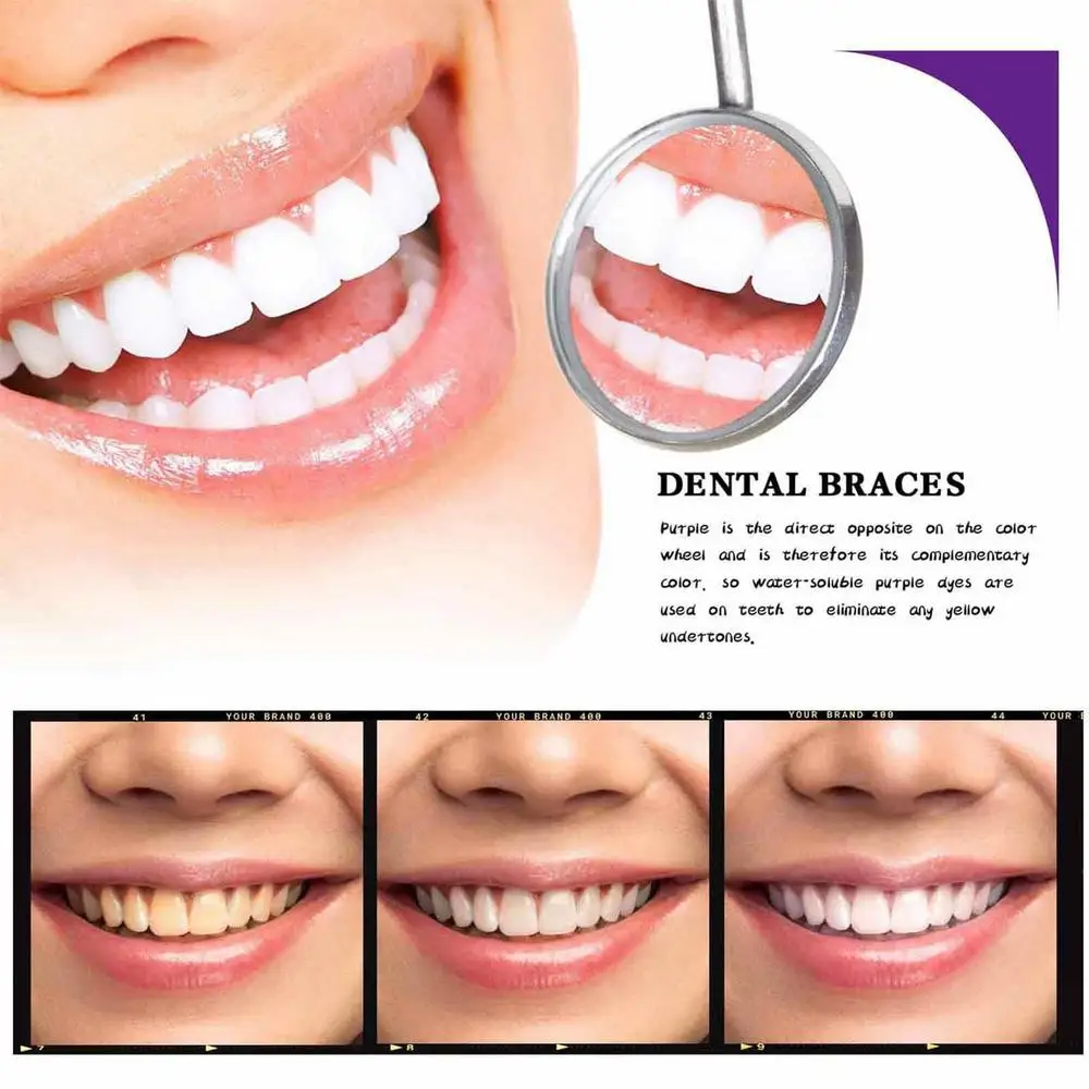 Smilekit espuma morada blanqueadora: ¡Despierta tu sonrisa radiante! - Smilekit espuma morada blanqueadora