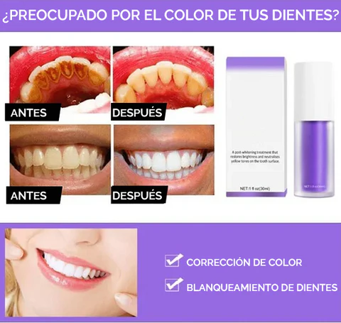 Más que blanqueamiento