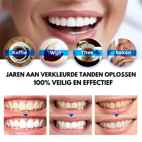 Lápiz Blanqueador de Dientes: ¡Sonríe con Confianza! - Lápiz blanqueador de dientes