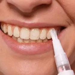 Tu Sonrisa, Tu Confianza