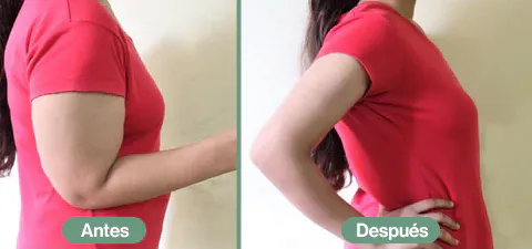 CREMA ANTIESTRÍAS SKINREPAIR