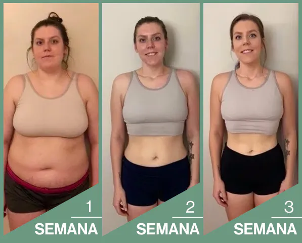 CREMA ANTIESTRÍAS SKINREPAIR