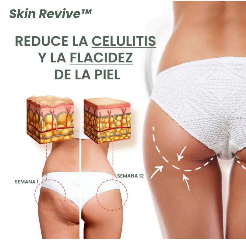 CREMA ANTIESTRÍAS SKINREPAIR