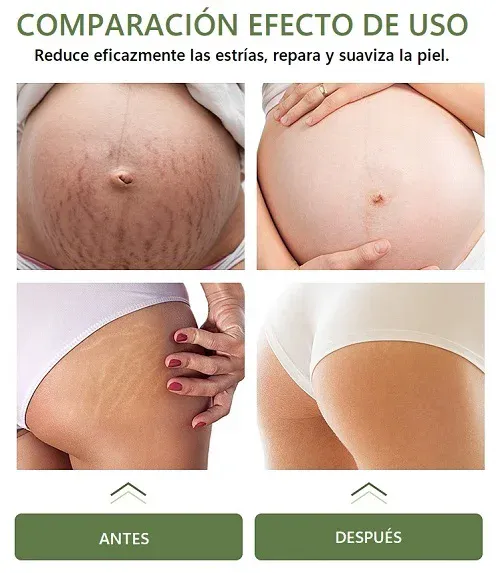Acerca de Skin Repair™