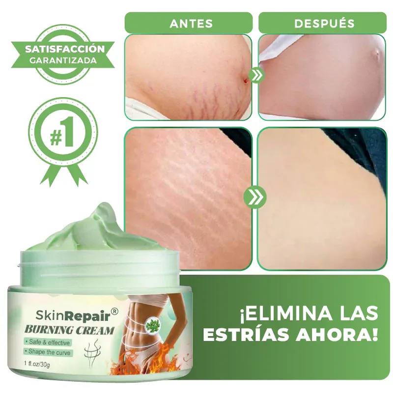 Beneficios de Skin Repair™
