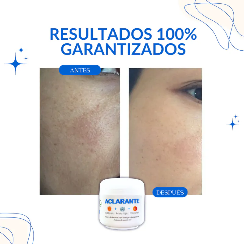 Crema Aclarante: ¡Despierta la Belleza Natural de tu Piel!