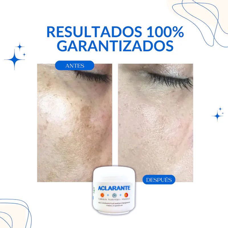 Cuidando tu Piel con Naturalidad