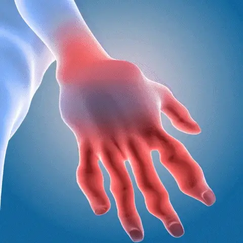 Dile Adiós al Dolor Crónico