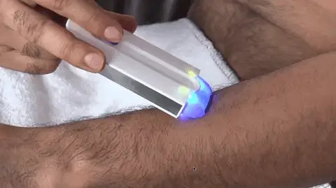 La Depilación del Futuro: Tecnología Innovadora