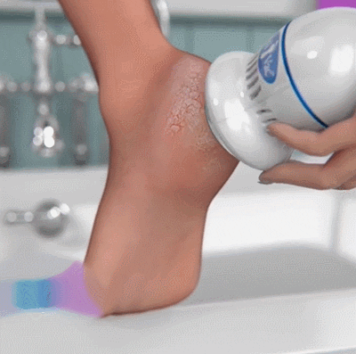 Quita Callos Eléctrico: Dile Adiós a los Pies Ásperos y Resecos