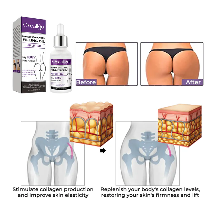 ACEITE REAFIRMANTE DE GLUTEOS: Realza tus Curvas con Oveallgo™ - ACEITE REAFIRMANTE DE GLUTEOS