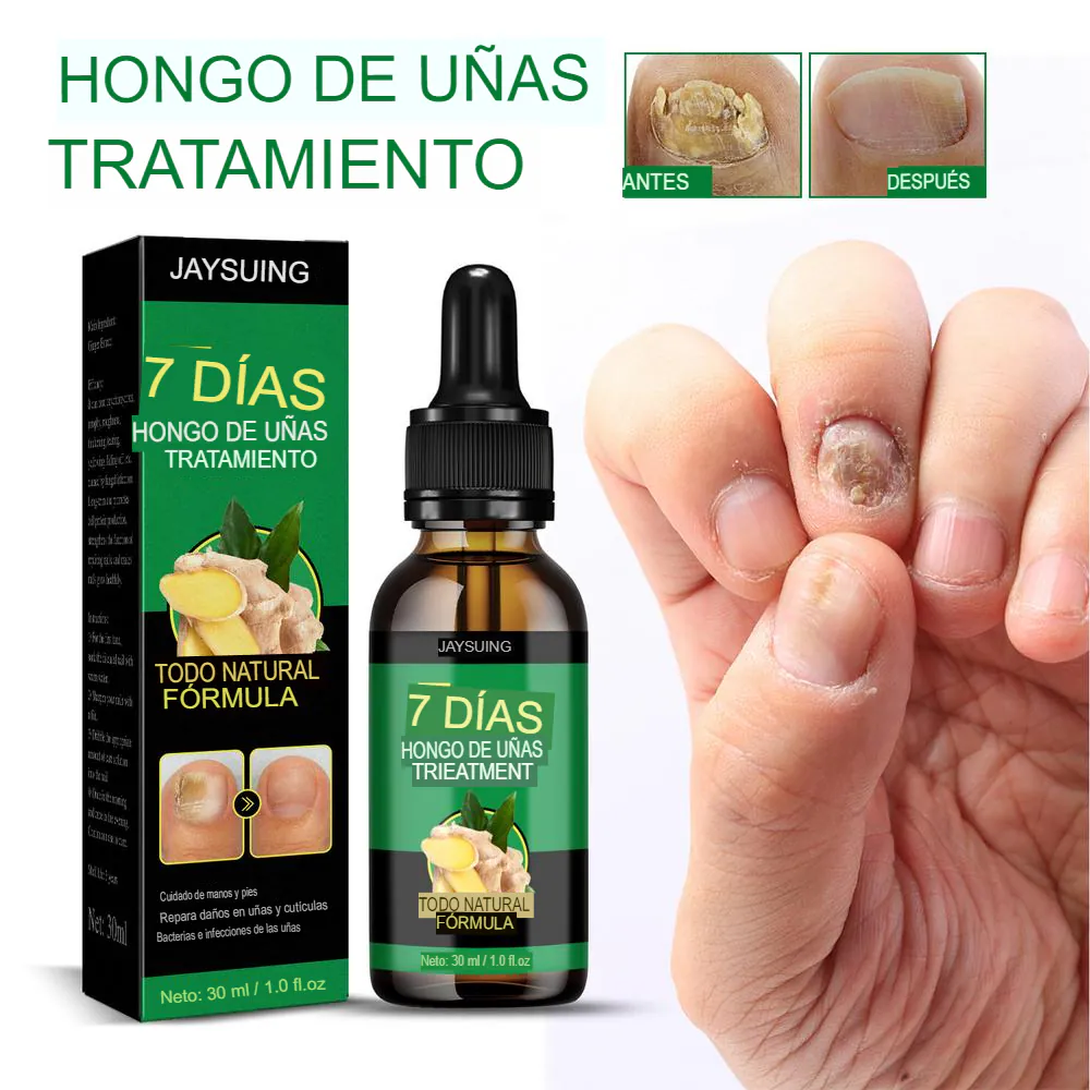 Aceite de Jengibre para Uñas: La Solución Natural para Uñas Saludables - Aceite Jengibre Uñas