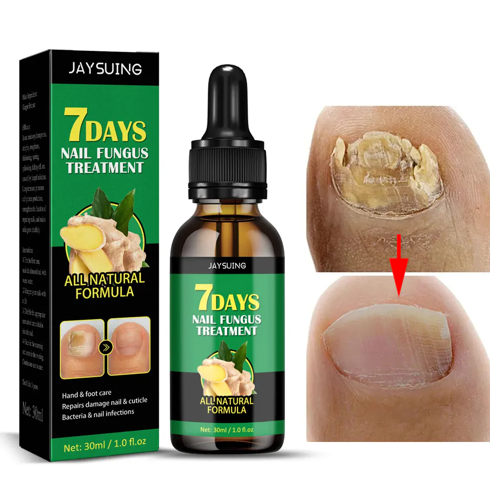 Aceite de Jengibre para Uñas: La Solución Natural para Uñas Saludables - Aceite Jengibre Uñas
