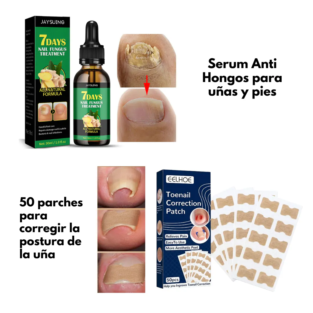 Aceite de Jengibre para Uñas: La Solución Natural para Uñas Saludables - Aceite Jengibre Uñas