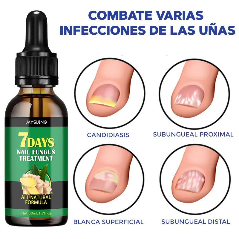 Aceite de Jengibre para Uñas: La Solución Natural para Uñas Saludables - Aceite Jengibre Uñas