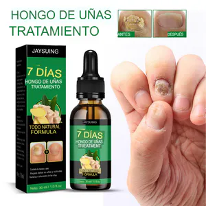 Aceite de Jengibre para Uñas: La Solución Natural para Uñas Saludables - Aceite Jengibre Uñas
