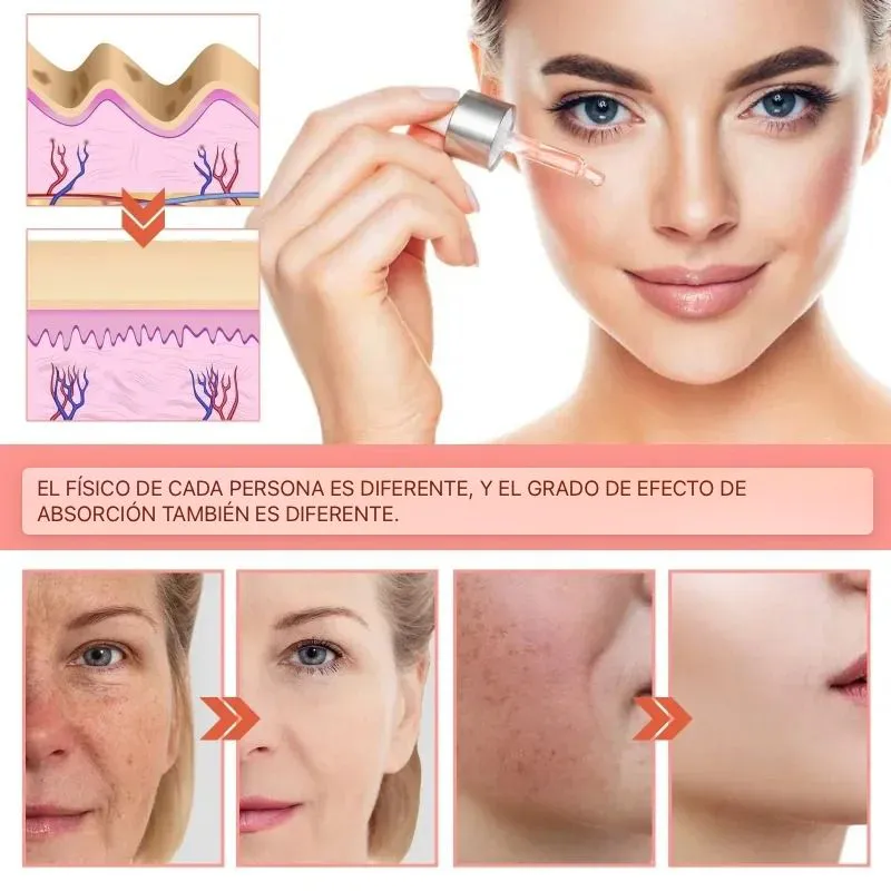 Beneficios de la Niacinamida