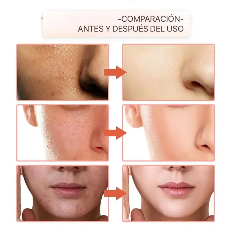 Descubre la Fórmula de SERUM 10