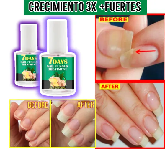 7 DAYS NAILS Endurecedor de Uñas: ¡Uñas Fuertes y Saludables en Solo 10 Días! - 7 DAYS NAILS endurecedor de uñas (3)
