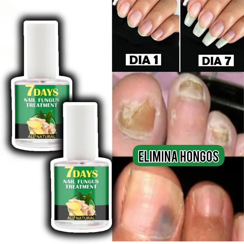 7 DAYS NAILS Endurecedor de Uñas: ¡Uñas Fuertes y Saludables en Solo 10 Días!