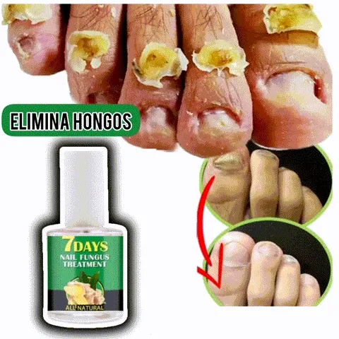 Crecimiento Acelerado