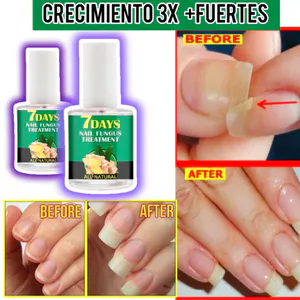 7 DAYS NAILS Endurecedor de Uñas: ¡Uñas Fuertes y Saludables en Solo 10 Días! - 7 DAYS NAILS endurecedor de uñas (3)