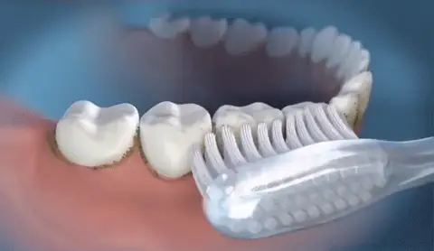 Dile Adiós a la Flossing Tradicional
