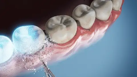 Tecnología Avanzada para una Sonrisa Radiante