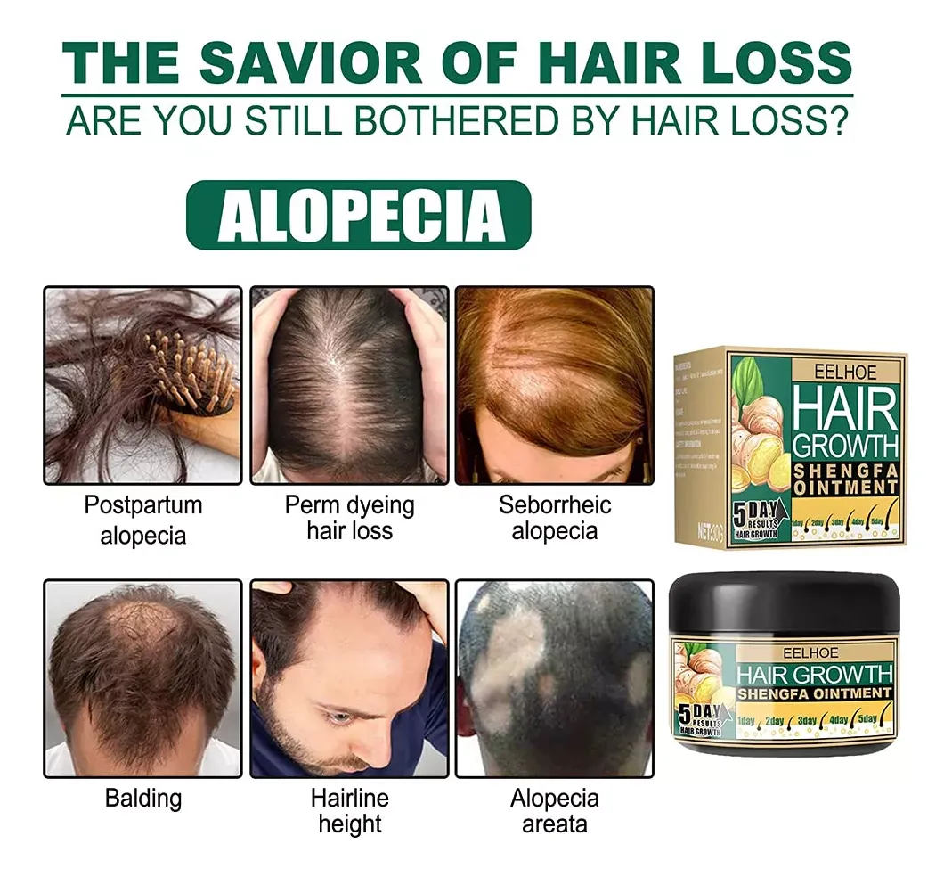 Crema Capilar para el Crecimiento del Cabello: Activa tu Cabello con Jengibre Natural - Hair Growth crema capilar