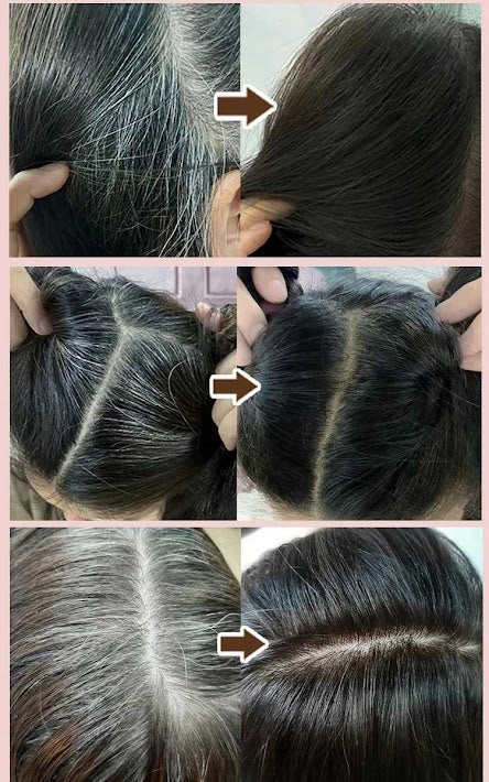 CANAS NEXO: El Secreto para un Cabello Libre de Canas - CANAS NEXO