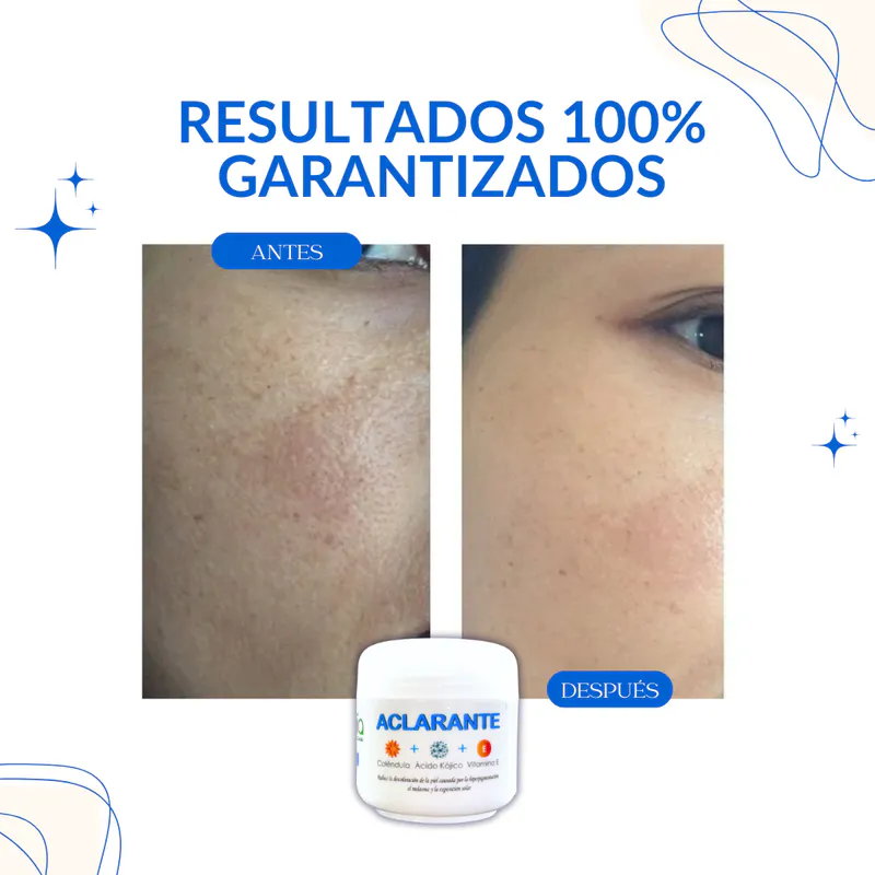 Sunblock Zamia: Protección Solar para una Piel Sana