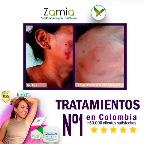 Crema Aclarante Zamia: Despierta tu Belleza Natural