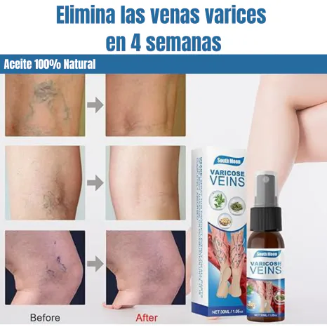 ADIOS VENAS SPRAY: ¡Dile Adiós a las Venas Varicosas! - ADIOS VENAS SPRAY