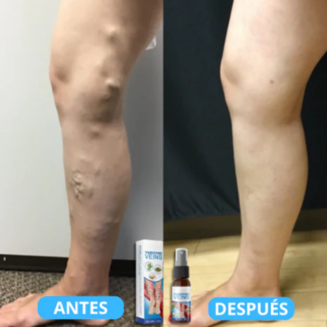 Alivio Inmediato