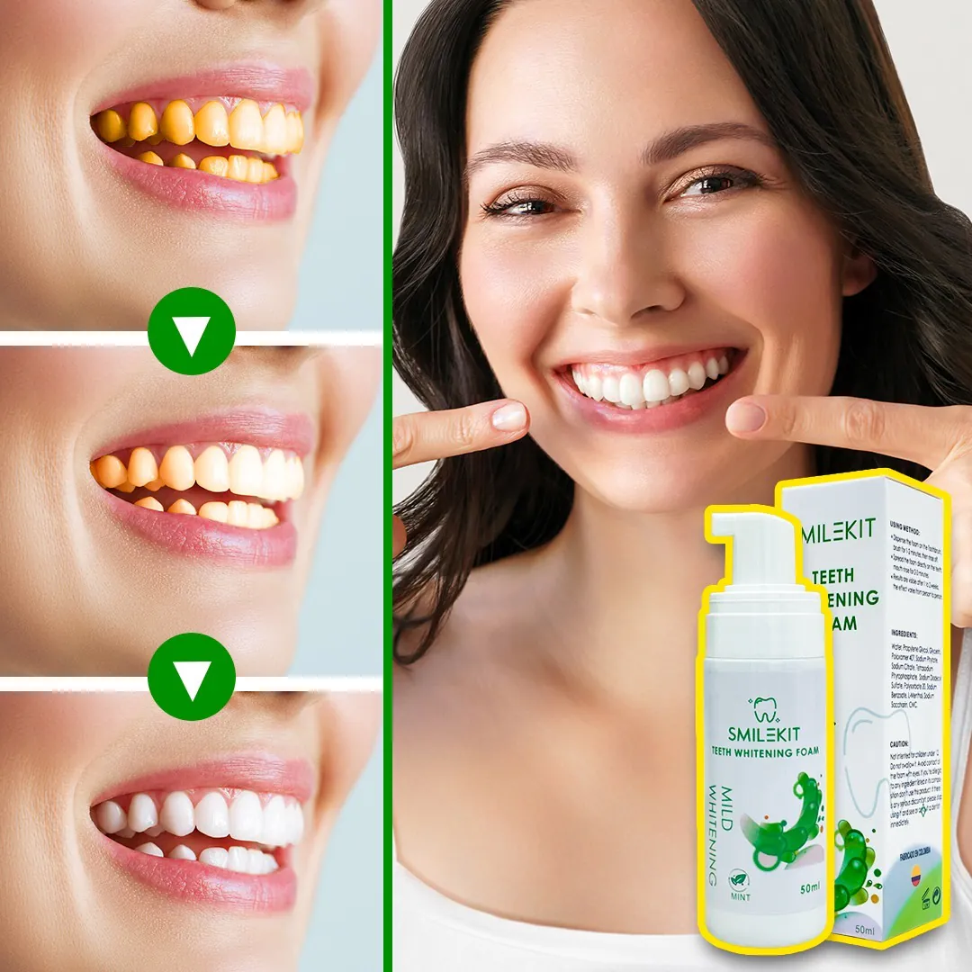 Smilekit Espuma Blanqueadora Dental: ¡Descubre una Sonrisa Radiante y Saludable! - Smilekit espuma blanqueadora dental