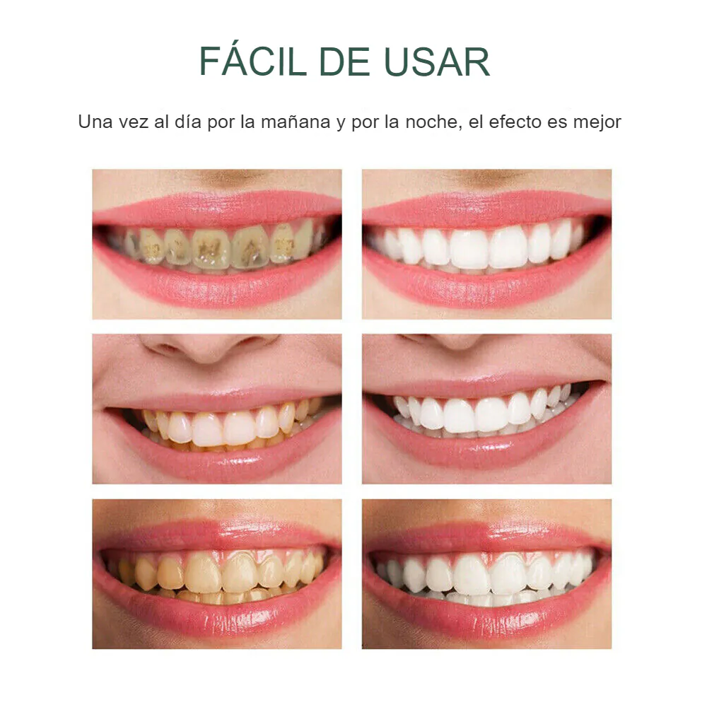 Smilekit Espuma Blanqueadora Dental: ¡Descubre una Sonrisa Radiante y Saludable! - Smilekit espuma blanqueadora dental