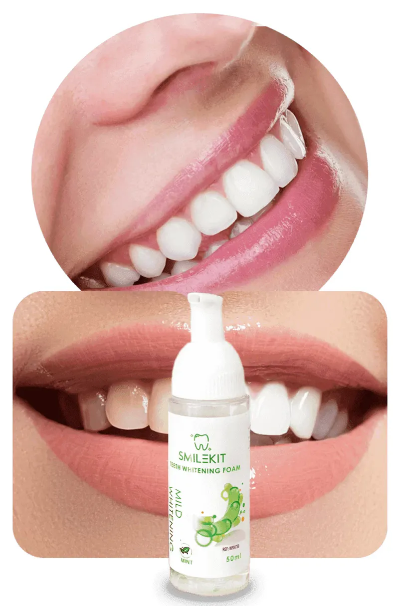 Smilekit Espuma Blanqueadora Dental: ¡Descubre una Sonrisa Radiante y Saludable!