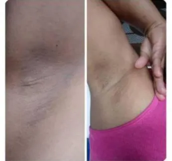 Crema Aclarante: Revelando la Belleza Natural de tu Piel - Crema aclarante (3)