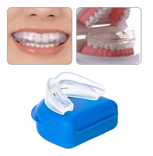Protector Bucal Dental Anti Bruxismo: Duerme Tranquilo y Despierta Revitalizado - Protector bucal dental bruxismo