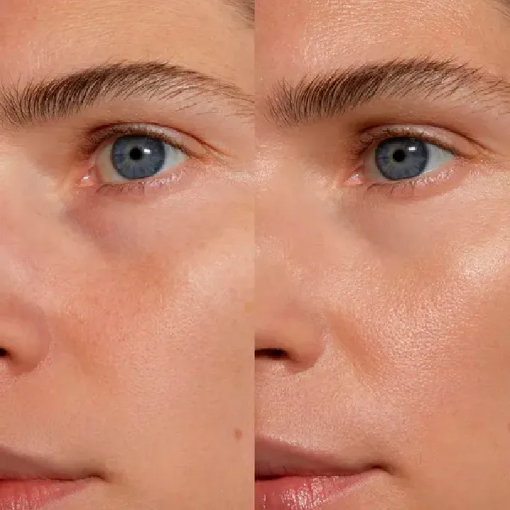 KIT RETINOL BIOAQUA CAJA DE LUJO: Tu Aliado Antienvejecimiento - KIT RETINOL BIOAQUA CAJA DE LUJO