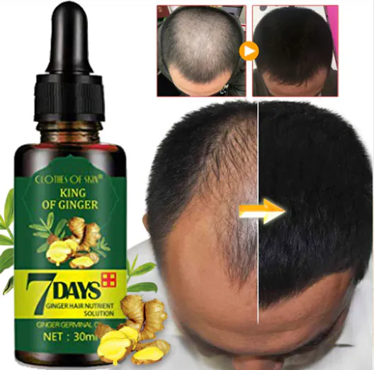 7 Days Crecimiento Capilar: Spray para un Cabello Más Fuerte y Abundante - 7 Days Crecimiento Capilar spray