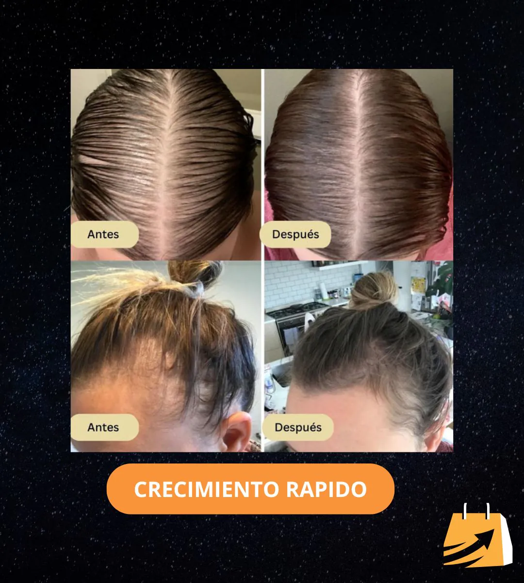 7 Days Crecimiento Capilar: Spray para un Cabello Más Fuerte y Abundante - 7 Days Crecimiento Capilar spray