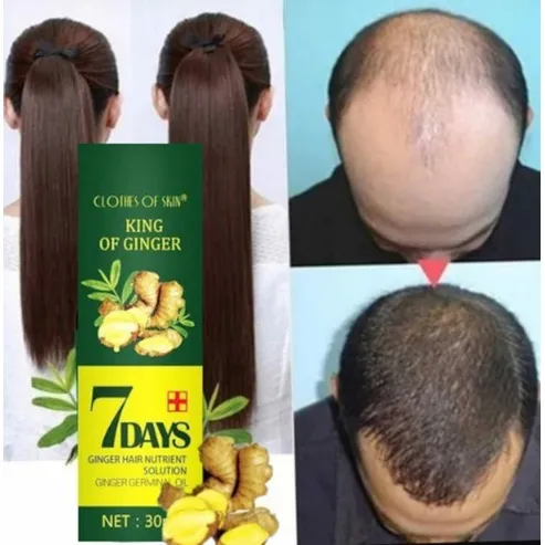 Dile Adiós a la Caída del Cabello