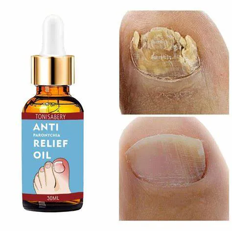 ANTI HONGOS - VIRAL ADSPY - ELIMINA HONGOS EN LAS UÑAS