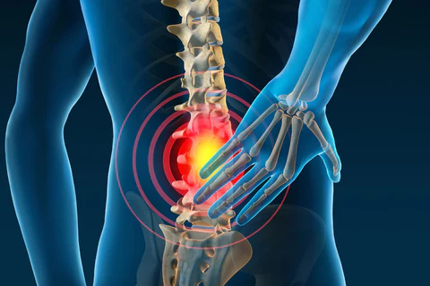 Cinturón Lumbar Ciática: Alivio Inmediato y Duradero para tu Dolor de Espalda