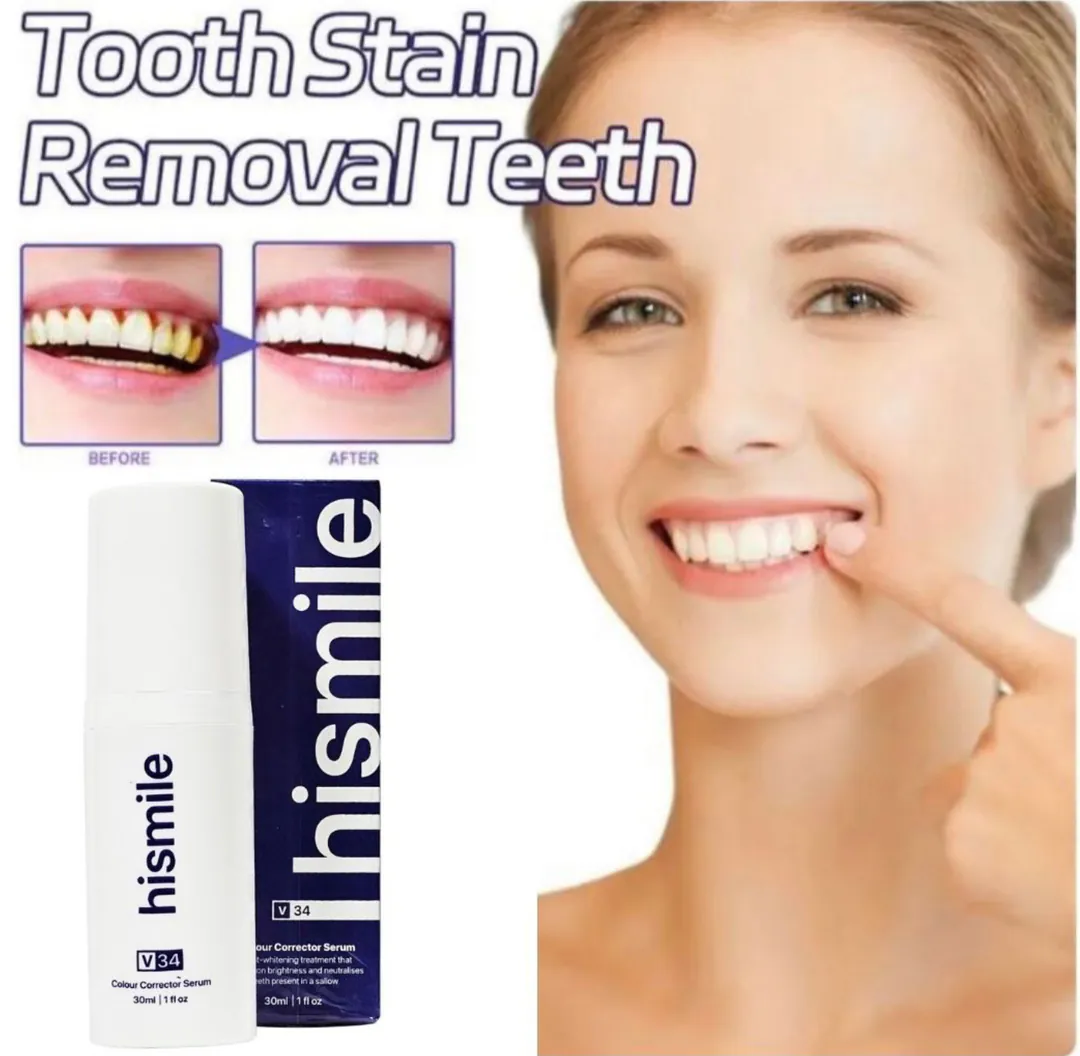 HISMILES Crema Dental Dientes v34: ¡La Revolución del Blanqueamiento Dental! - HISMILES crema dental dientes v34