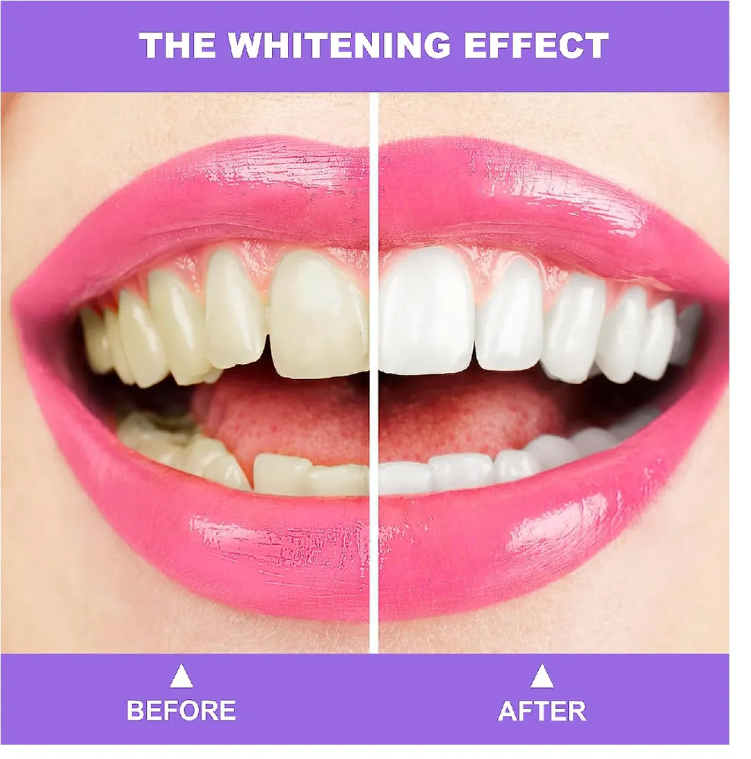 HISMILES Crema Dental Dientes v34: ¡La Revolución del Blanqueamiento Dental! - HISMILES crema dental dientes v34
